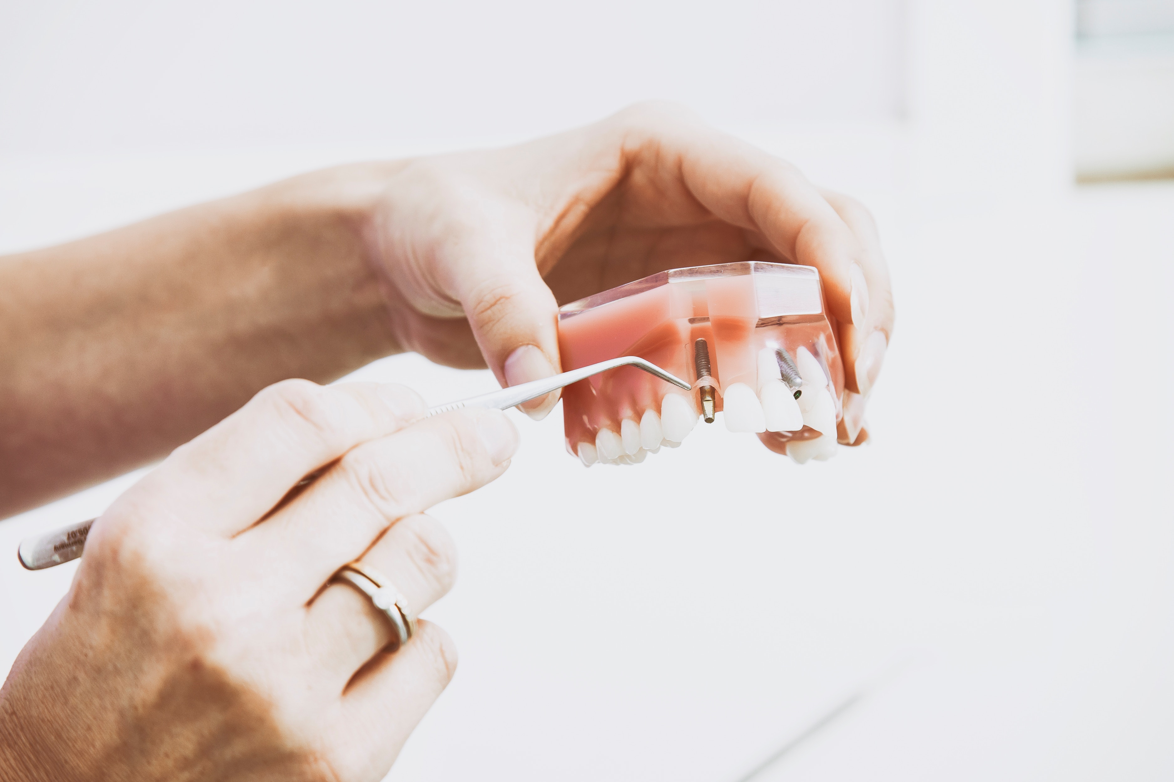 Advanced Dental Care Implants