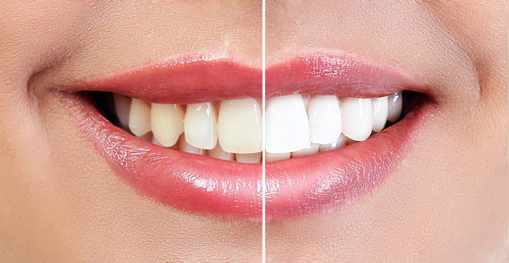 Cosmetic Dentistry In Brooklyn